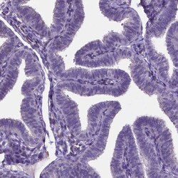 Invitrogen MLC1 Polyclonal Antibody 100 &mu;L; Unconjugated:Antibodies,