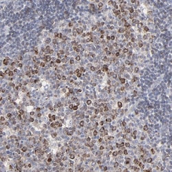 Invitrogen VPREB3 Polyclonal Antibody 100 &mu;L; Unconjugated:Antibodies,