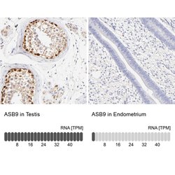 Invitrogen ASB9 Polyclonal Antibody 100 &mu;L; Unconjugated:Antibodies,