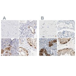 Invitrogen ASB9 Polyclonal Antibody 100 &mu;L; Unconjugated:Antibodies,