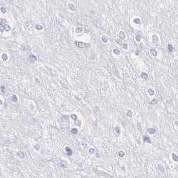 Invitrogen ASB9 Polyclonal Antibody 100 &mu;L; Unconjugated:Antibodies,