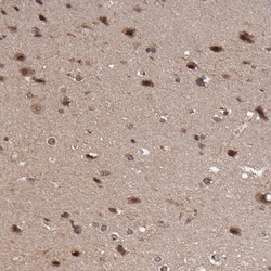 Invitrogen RGS6 Polyclonal Antibody 100 &mu;L; Unconjugated:Antibodies,