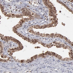 Invitrogen RGS6 Polyclonal Antibody 100 &mu;L; Unconjugated:Antibodies,
