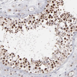 Invitrogen RGS6 Polyclonal Antibody 100 &mu;L; Unconjugated:Antibodies,