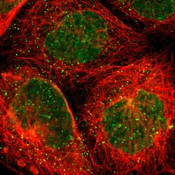 Invitrogen THAP7 Polyclonal Antibody 100 &mu;L; Unconjugated:Antibodies,