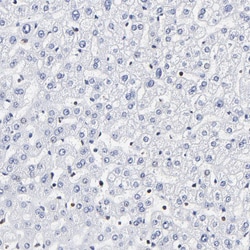 Invitrogen THAP7 Polyclonal Antibody 100 &mu;L; Unconjugated:Antibodies,