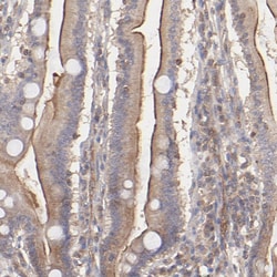 Invitrogen STON2 Polyclonal Antibody 100 &mu;L; Unconjugated:Antibodies,