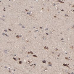 Invitrogen STON2 Polyclonal Antibody 100 &mu;L; Unconjugated:Antibodies,