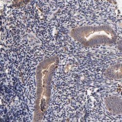 Invitrogen STON2 Polyclonal Antibody 100 &mu;L; Unconjugated:Antibodies,