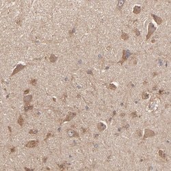 Invitrogen STON2 Polyclonal Antibody 100 &mu;L; Unconjugated:Antibodies,