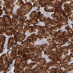 Invitrogen FANCB Polyclonal Antibody 100 &mu;L; Unconjugated:Antibodies,