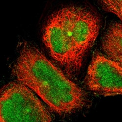 Invitrogen CCDC176 Polyclonal Antibody 100 &mu;L; Unconjugated:Antibodies,