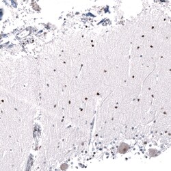Invitrogen AFF2 Polyclonal Antibody 100 &mu;L; Unconjugated:Antibodies,