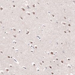 Invitrogen AFF2 Polyclonal Antibody 100 &mu;L; Unconjugated:Antibodies,