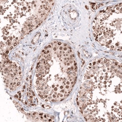 Invitrogen AFF2 Polyclonal Antibody 100 &mu;L; Unconjugated:Antibodies,