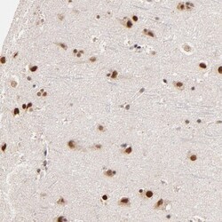 Invitrogen ZNF670 Polyclonal Antibody 100 &mu;L; Unconjugated:Antibodies,