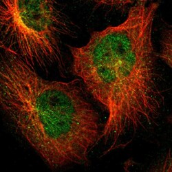 Invitrogen ZNF44 Polyclonal Antibody 100 &mu;L; Unconjugated:Antibodies,