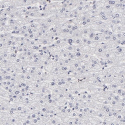Invitrogen ZNF773 Polyclonal Antibody 100 &mu;L; Unconjugated:Antibodies,