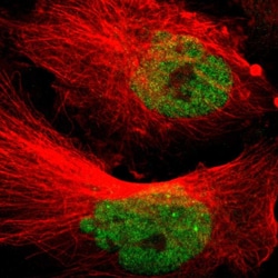 Invitrogen PCQAP Polyclonal Antibody 100 &mu;L; Unconjugated:Antibodies,