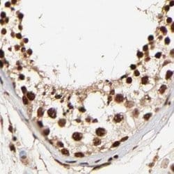 Invitrogen MED12 Polyclonal Antibody 100 &mu;L; Unconjugated:Antibodies,