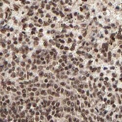 Invitrogen MED12 Polyclonal Antibody 100 &mu;L; Unconjugated:Antibodies,