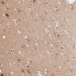 Invitrogen RIBC2 Polyclonal Antibody 100 &mu;L; Unconjugated:Antibodies,