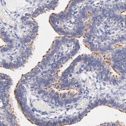 Invitrogen RIBC2 Polyclonal Antibody 100 &mu;L; Unconjugated:Antibodies,