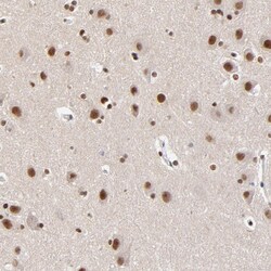 Invitrogen ZMYM3 Polyclonal Antibody 100 &mu;L; Unconjugated:Antibodies,