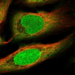 Invitrogen ZNF184 Polyclonal Antibody 100 &mu;L; Unconjugated:Antibodies,