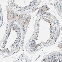 Invitrogen ZNF184 Polyclonal Antibody 100 &mu;L; Unconjugated:Antibodies,