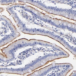 Invitrogen SLC44A2 Polyclonal Antibody 100 &mu;L | Buy Online | Invitrogen&trade; | Fisher Scientific