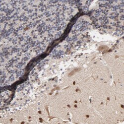 Invitrogen CHM Polyclonal Antibody 100 &mu;L; Unconjugated:Antibodies,