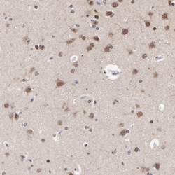 Invitrogen CHM Polyclonal Antibody 100 &mu;L; Unconjugated:Antibodies,