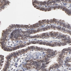 Invitrogen CHM Polyclonal Antibody 100 &mu;L; Unconjugated:Antibodies,