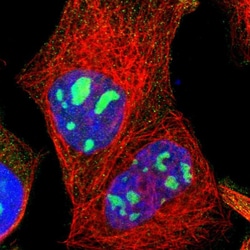 Invitrogen LRCH2 Polyclonal Antibody 100 &mu;L; Unconjugated:Antibodies,