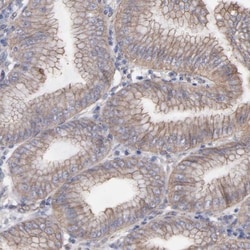 Invitrogen LRCH2 Polyclonal Antibody 100 &mu;L; Unconjugated:Antibodies,