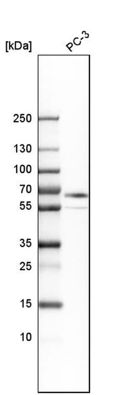 Invitrogen ABLIM3 Polyclonal Antibody 100 &mu;L; Unconjugated:Antibodies,