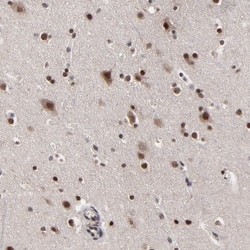 Invitrogen ZNF777 Polyclonal Antibody 100 &mu;L; Unconjugated:Antibodies,