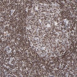 Invitrogen ZNF143 Polyclonal Antibody 100 &mu;L; Unconjugated:Antibodies,