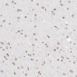 Invitrogen ZNF143 Polyclonal Antibody 100 &mu;L; Unconjugated:Antibodies,