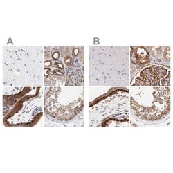 Invitrogen CD2AP Polyclonal Antibody 100 &mu;L; Unconjugated:Antikroppar