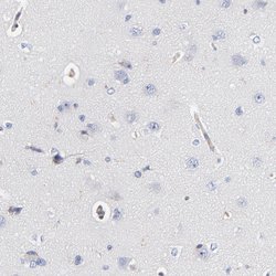Invitrogen CD2AP Polyclonal Antibody 100 &mu;L; Unconjugated:Antikroppar