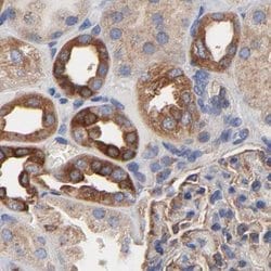 Invitrogen CD2AP Polyclonal Antibody 100 &mu;L; Unconjugated:Antikroppar