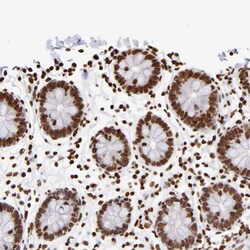 Invitrogen ZCCHC16 Polyclonal Antibody 100 &mu;L | Buy Online | Invitrogen&trade; | Fisher Scientific