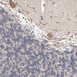 Invitrogen ASB8 Polyclonal Antibody 100 &mu;L; Unconjugated:Antibodies,