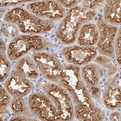 Invitrogen ASB8 Polyclonal Antibody 100 &mu;L; Unconjugated:Antibodies,