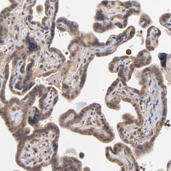 Invitrogen ASB8 Polyclonal Antibody 100 &mu;L; Unconjugated:Antibodies,