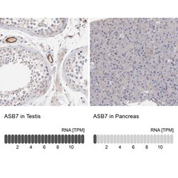 Invitrogen ASB7 Polyclonal Antibody 100 &mu;L; Unconjugated:Antibodies,