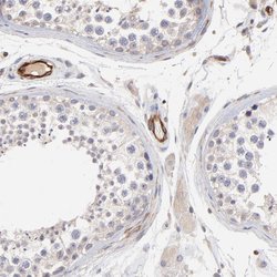 Invitrogen ASB7 Polyclonal Antibody 100 &mu;L; Unconjugated:Antibodies,