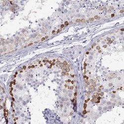 Invitrogen RHOXF2 Polyclonal Antibody 100 &mu;L | Buy Online | Invitrogen&trade; | Fisher Scientific